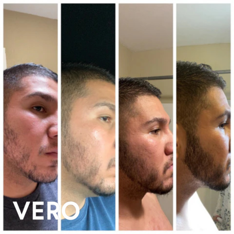 Vero Beard Regrowth Kit
