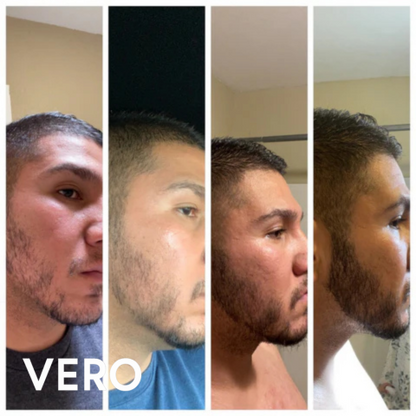 Vero Beard Regrowth Kit